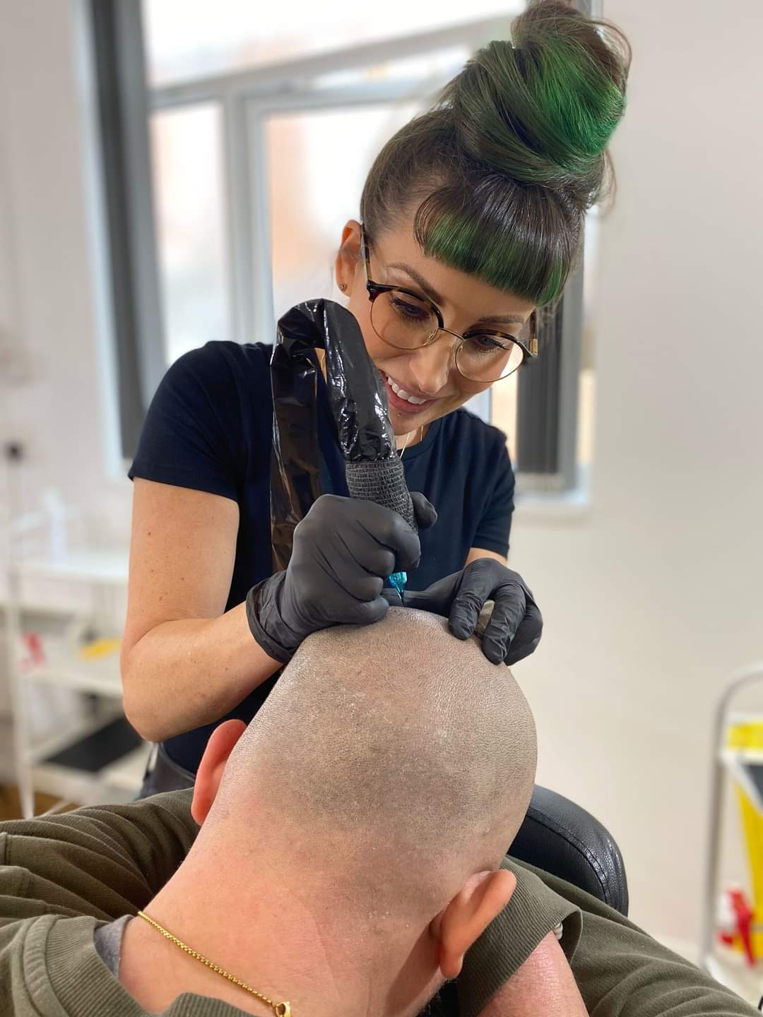 Scalp SMP Leicester Tattoo Hair Loss Solutions For All Genders.